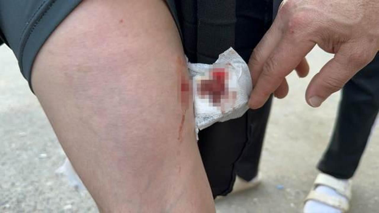 Sakarya'da 11 yaşındaki kız çocuğu sokak köpeğinin saldırısına uğradı