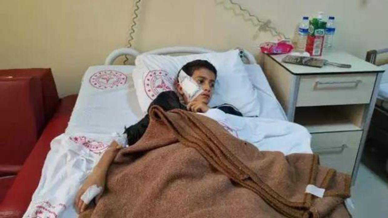 Diyarbakır'da sahipsiz köpeğin saldırdığı çocuk yaralandı