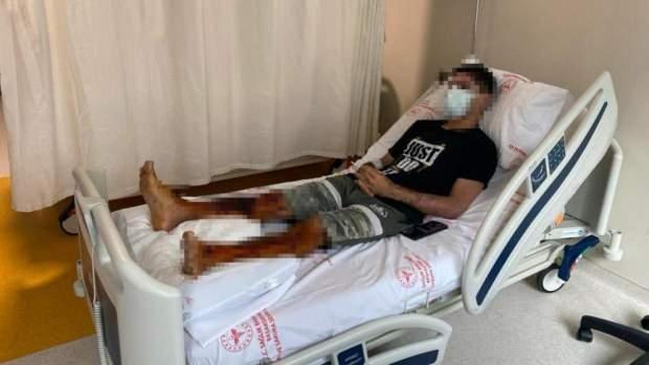 Tıkanan lavabosunu a&ccedil;mak isterken dehşeti yaşadı