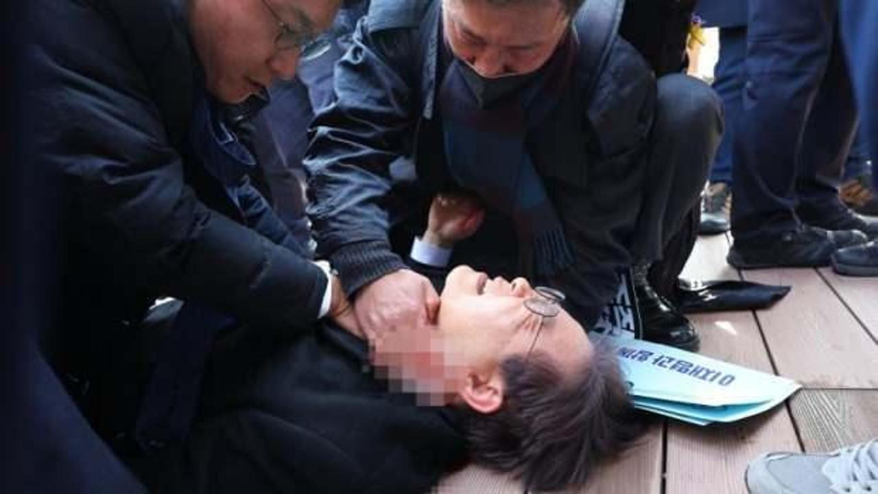  Güney Kore’de boynundan bıçaklanan ana muhalefet liderinin son durumu