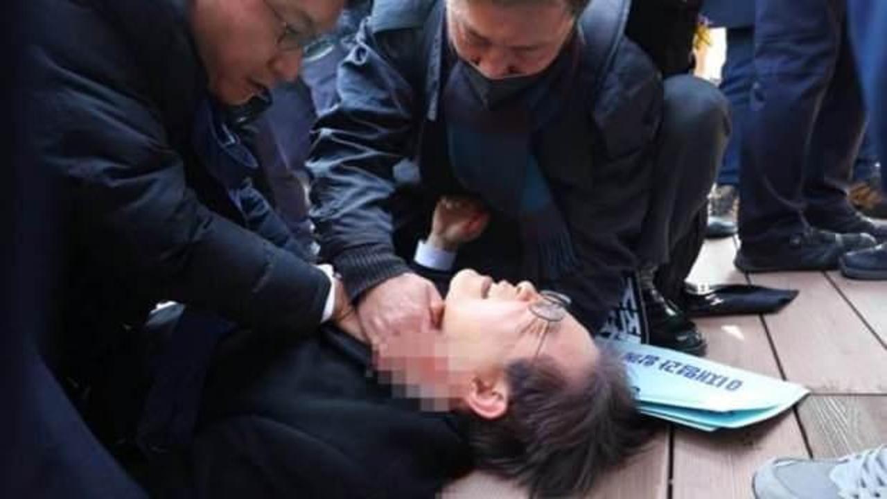 Muhalefet lideri boynundan bıçaklanmıştı, işte son durumu!