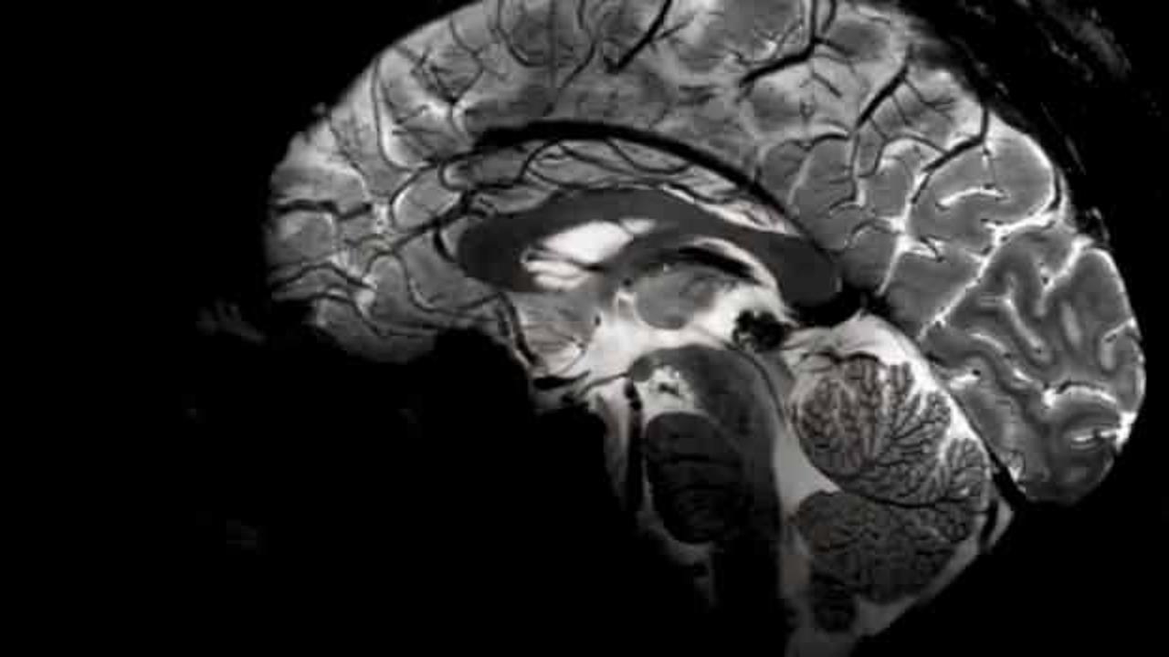Dnyann en byk MRI cihazyla ekildi: nsan beyni ilk kez bu kadar net grntlendi...
