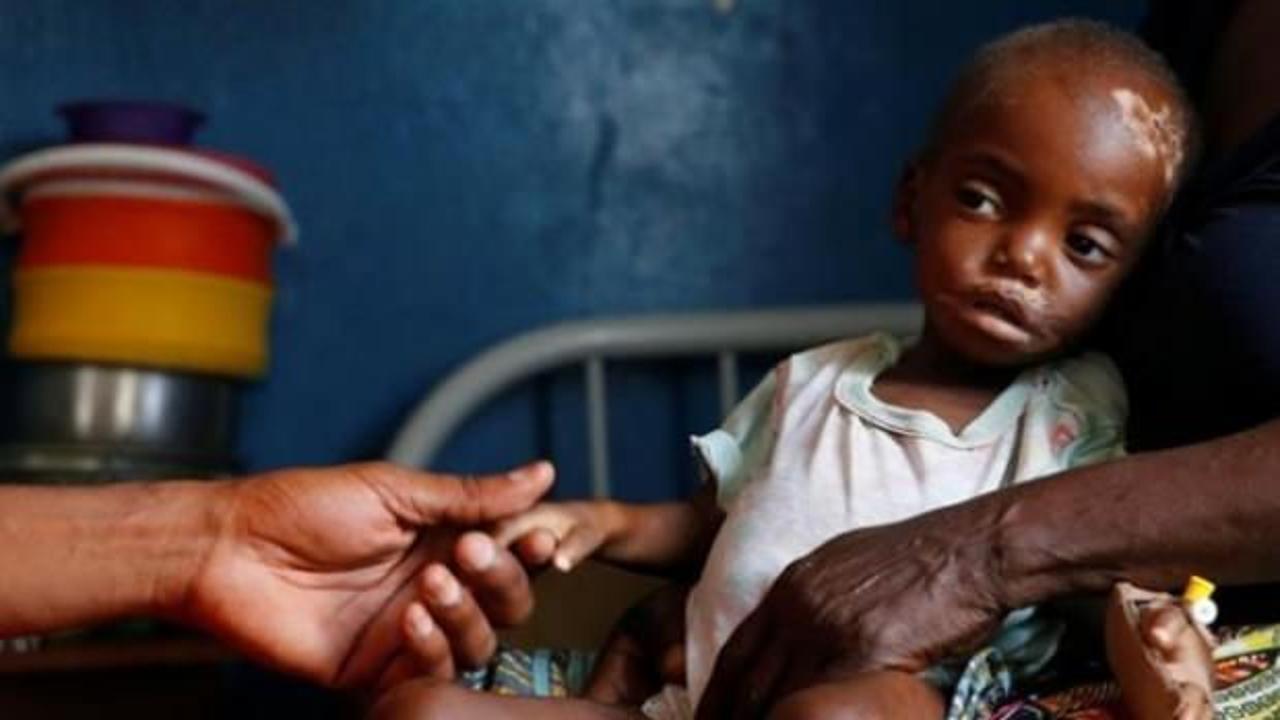 Nijerya'da teşhis konulamayan hastalık! Ölümler başladı