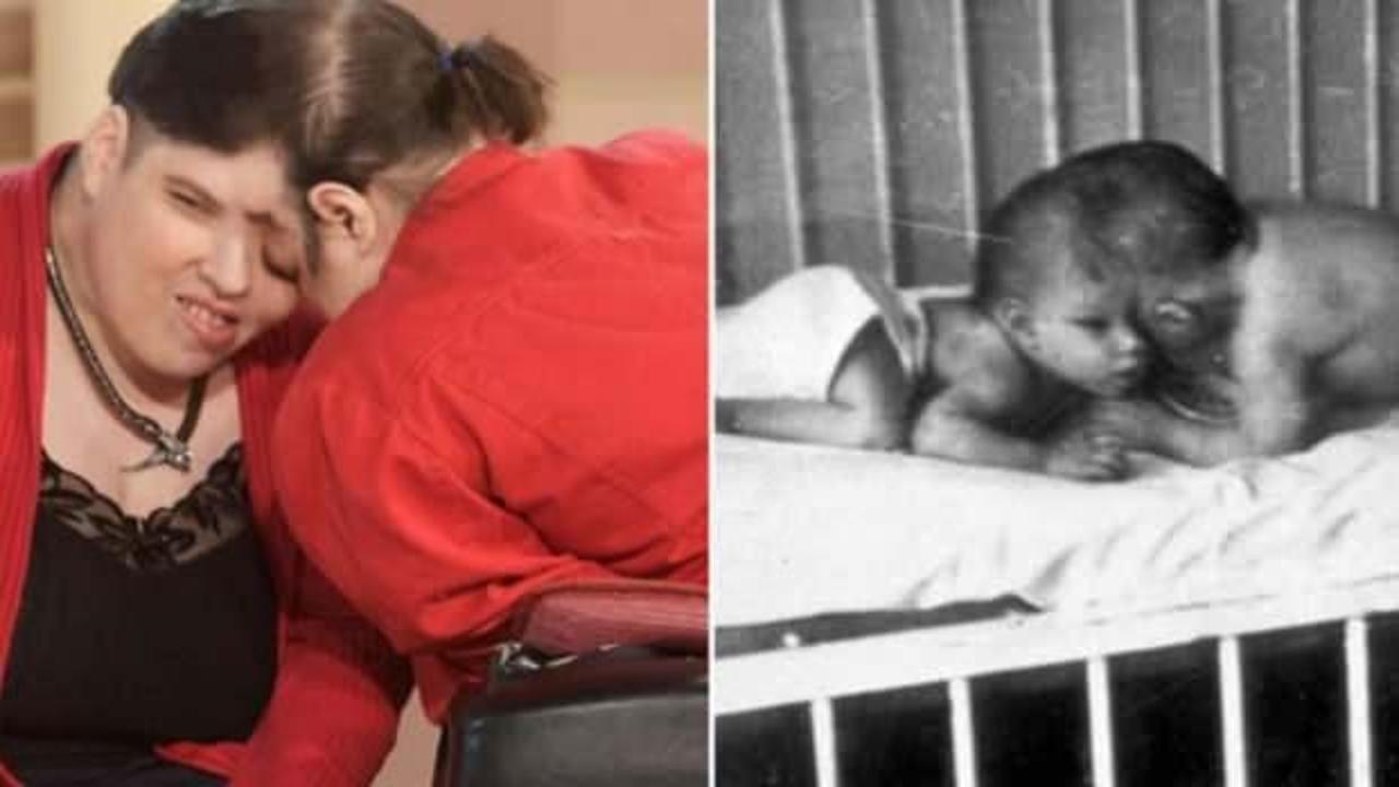 D&uuml;nyanın en yaşlı ikizleri onlardı! Acı haber geldi