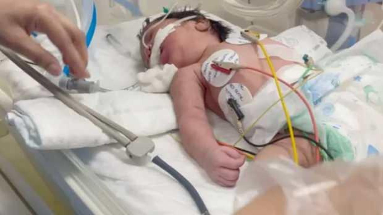 İsrail vahşeti durmuyor: Gazze'de a&ccedil;lıktan &ouml;len &ccedil;ocukların sayısı 30'a y&uuml;kseldi