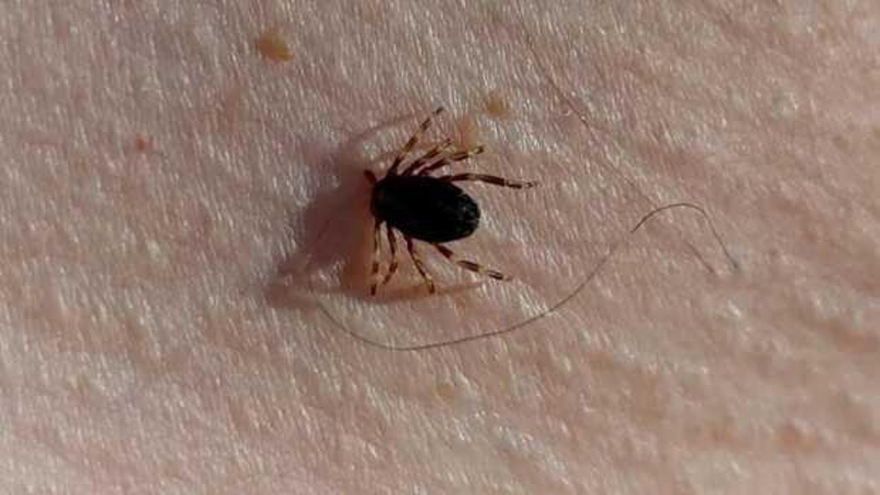 Türkiye genelinde vakalar arttı! Uzmanlar uyardı