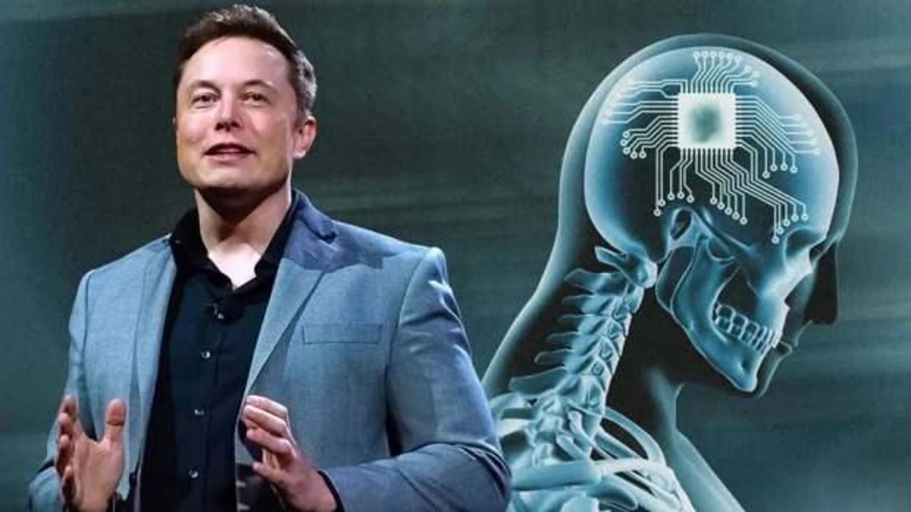 Elon Musk'ın beyin çipi arıza yaptı!