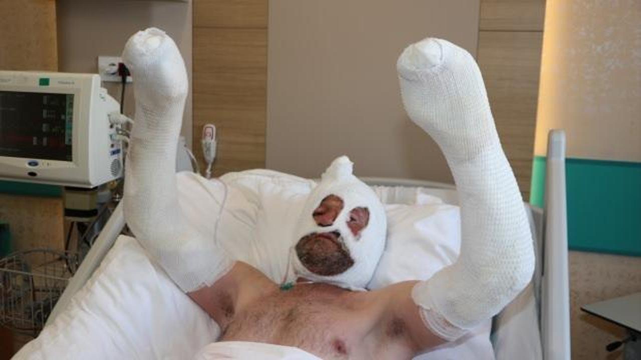 Soba yakmak isterken canından oluyordu!