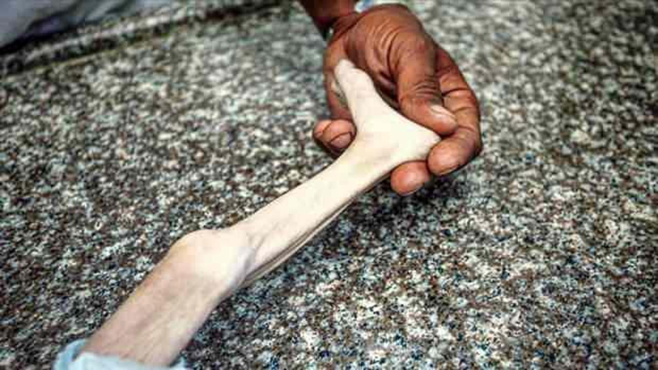 Gazze'de 7 aylık bebek, Ebu Ataya a&ccedil;lıktan &ouml;ld&uuml;!