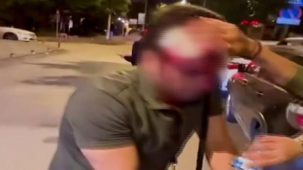 Ankara'da yolcularla taksici arasında kısa mesafe kavgası: 4 yaralı!
