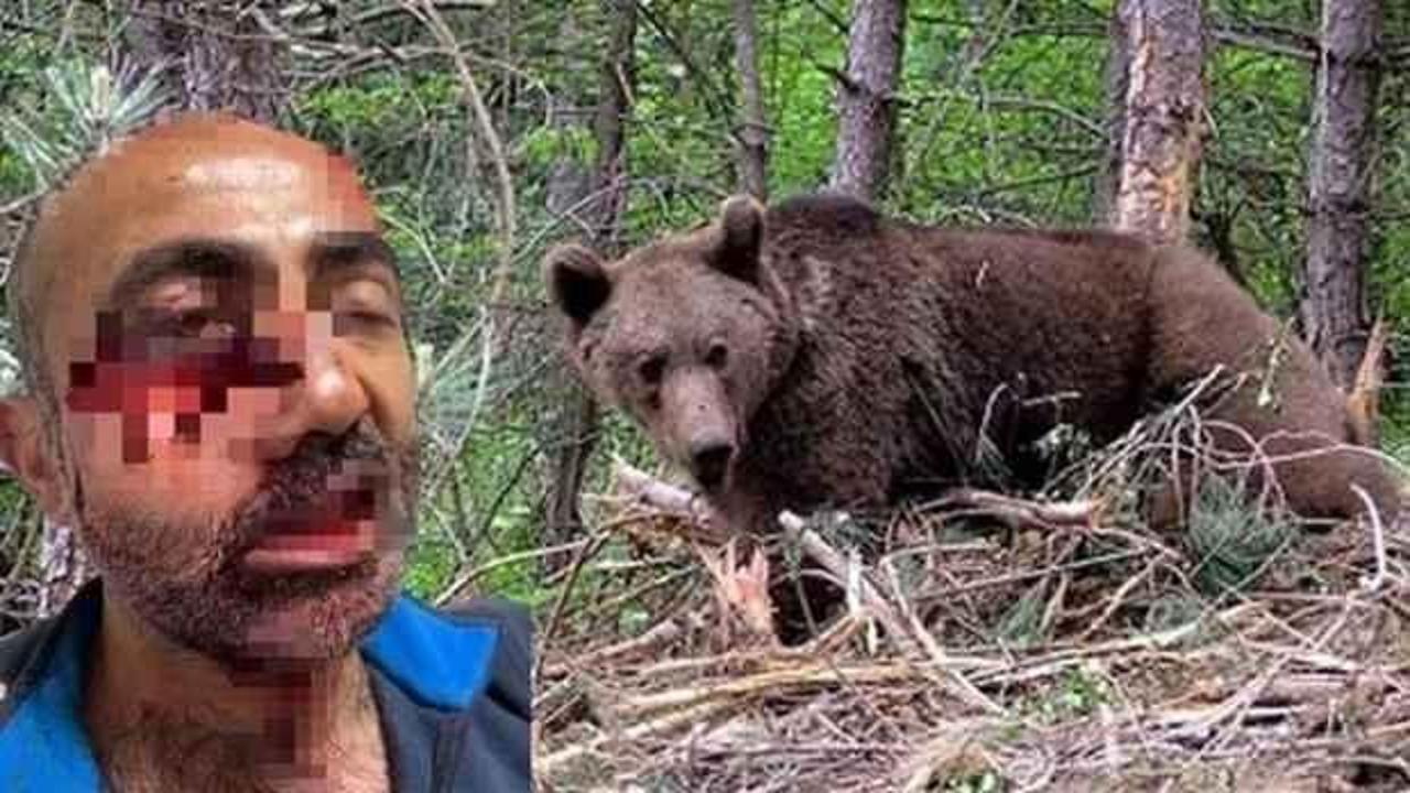 Hakkari'de ayı saldırısı: Y&uuml;z&uuml; ve &ccedil;enesi par&ccedil;alandı