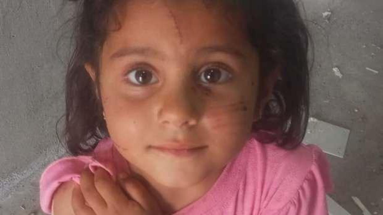 Oyun oynarken dehşeti yaşadı! 4 yaşındaki Eyl&uuml;l 2 k&ouml;peğin saldırısına uğradı