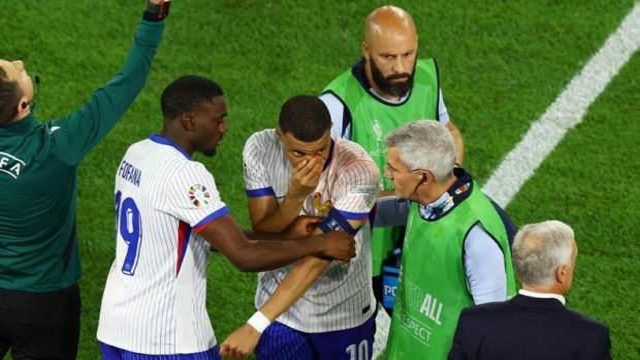Burnu kırılan Mbappe'den Fransa'ya k&ouml;t&uuml; haber! 