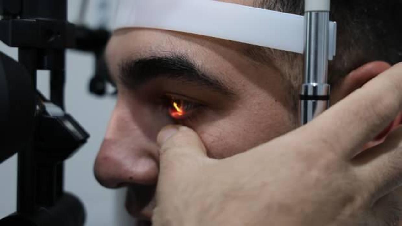 G&ouml;zlerde hasar bırakan vir&uuml;se dikkat! Tedavi edilmezse &ouml;m&uuml;r boyu izi kalıyor