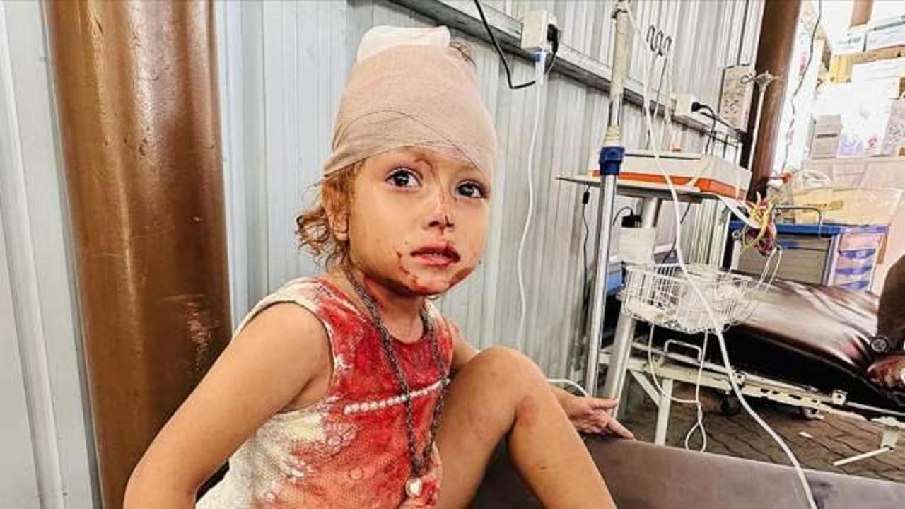 İsrail'in Gazze'ye saldırısında 2 Filistinli &ouml;ld&uuml;