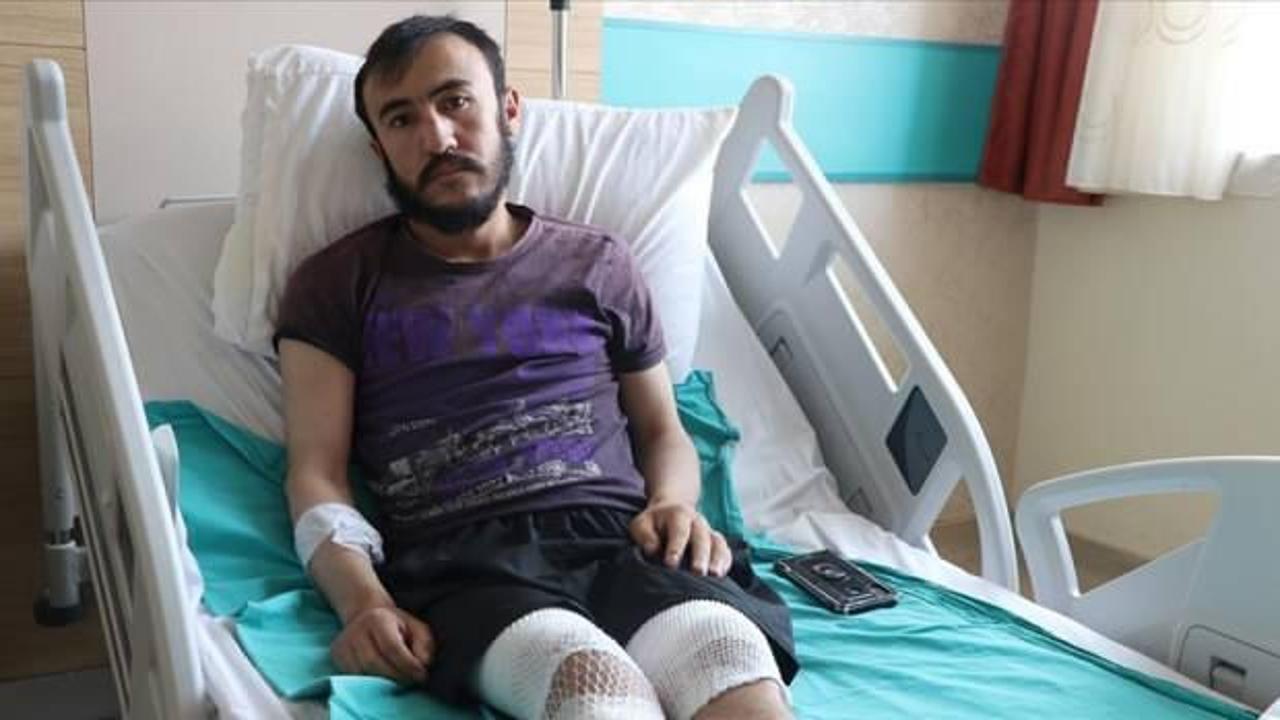 Yıldırım isabet eden &ccedil;obanın bacakları cilt nakli ve cerrahi m&uuml;dahaleyle kurtarıldı