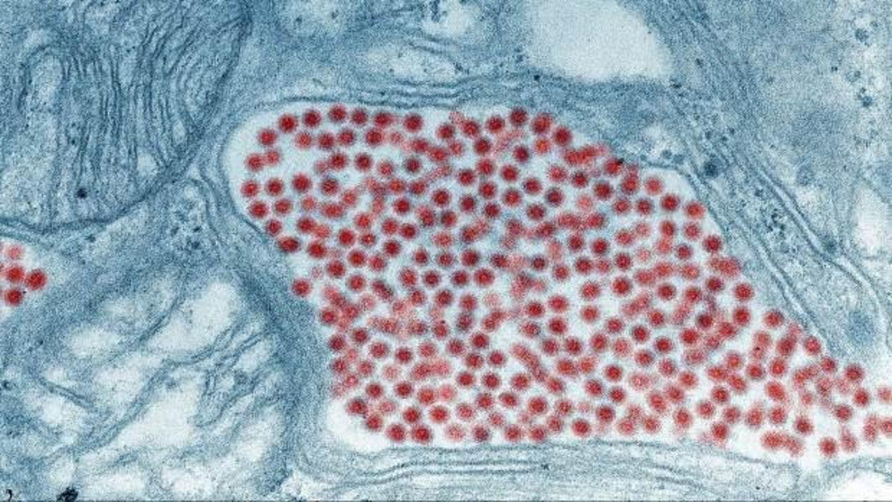 ABD'de yeni virüs alarmı - Haber 7 DÜNYA