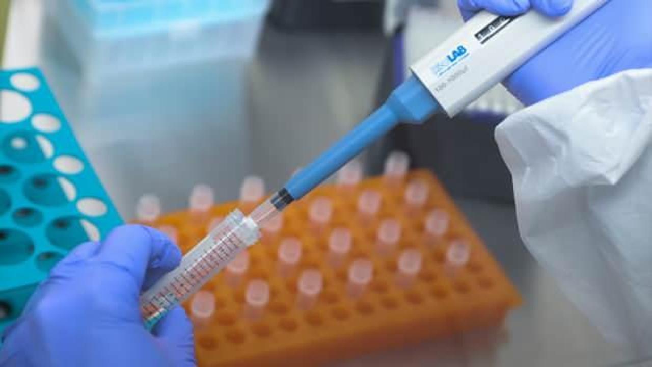 Prof. Dr. &Ccedil;ift&ccedil;i: Bize gelen gribal şikayetlerinin y&uuml;zde 60'ı Covid-19 vakası