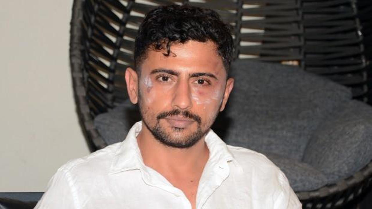 Diş hekimi "husumetlisini tedavi ettiği" gerek&ccedil;esiyle darp edildi