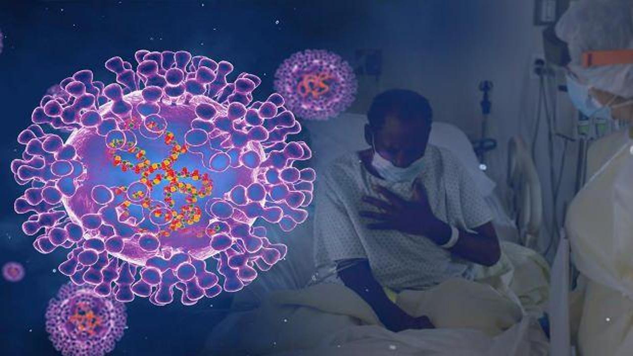 DS&Ouml; duyurdu 30 bin vaka g&ouml;r&uuml;ld&uuml;...  Maymun &ccedil;i&ccedil;eği bilan&ccedil;osu ağırlaşıyor 