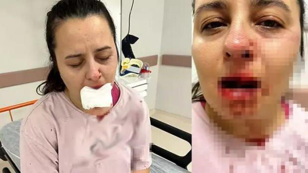 Balyozla saldırdığı yeğeninin çenesini ve 1 dişini kırdı!
