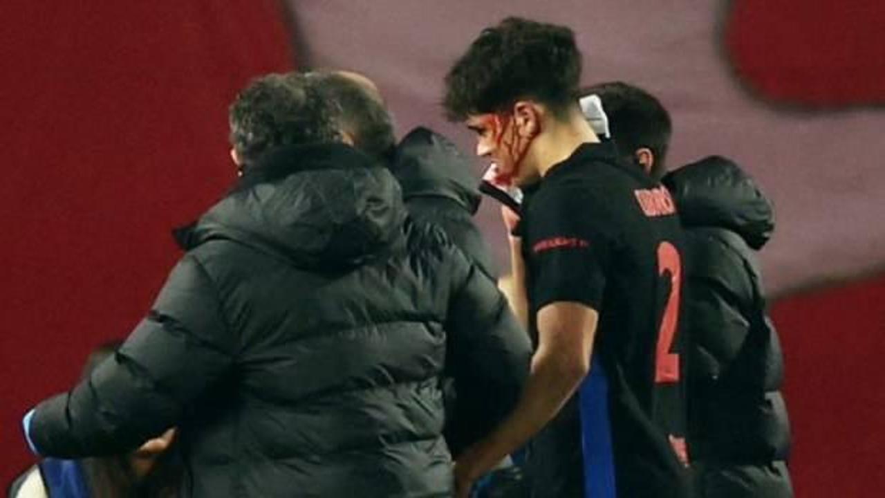 Devler Ligi'nde korkutan anlar! Gen&ccedil; yıldız kanlar i&ccedil;inde kaldı