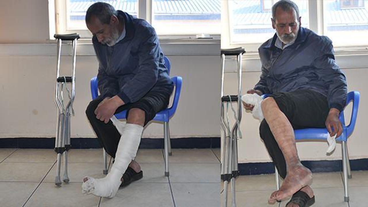 Her gün engelli taklidi yapıyordu: Gerçek 'pes' dedirtti! 19 suç kaydı çıktı