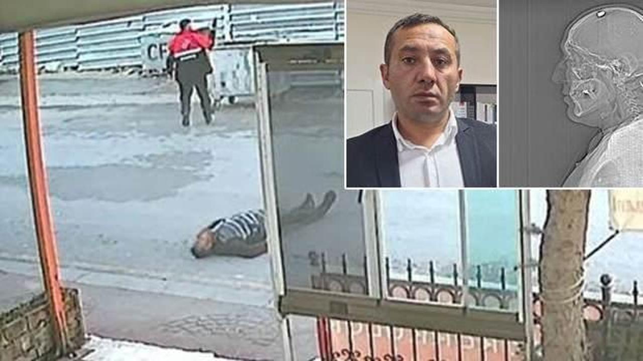 Silahla başından vuruldu, &ouml;l&uuml; taklidi yaparak kurtuldu!