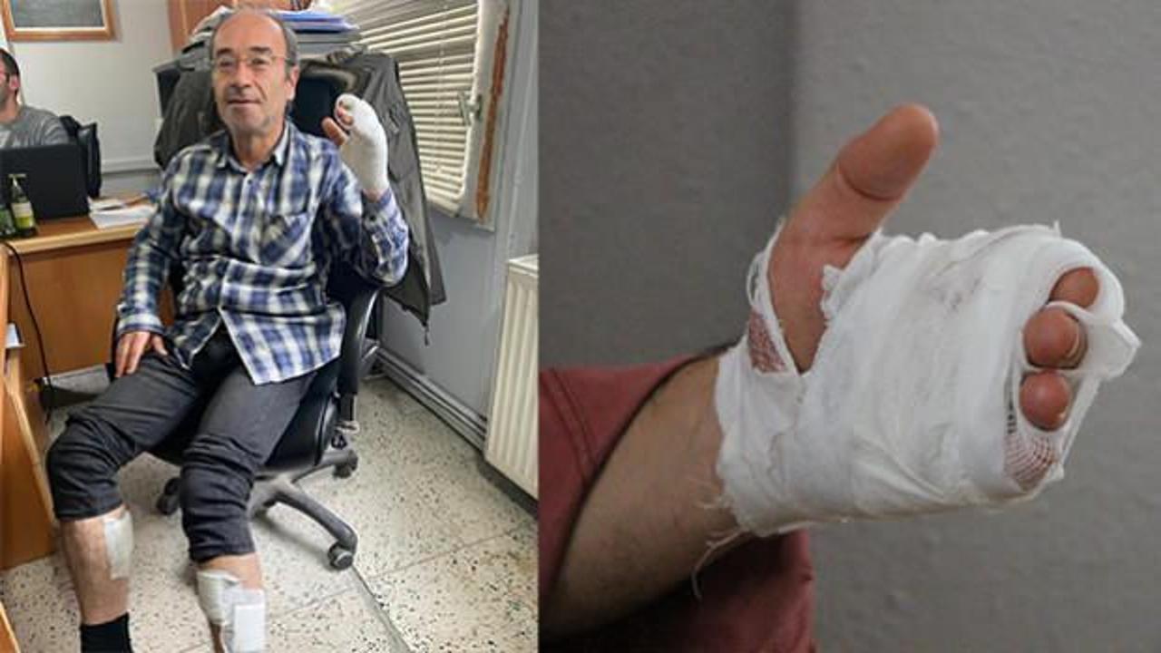 Amasya'da 30 yıllık veteriner hekime k&ouml;pek saldırdı