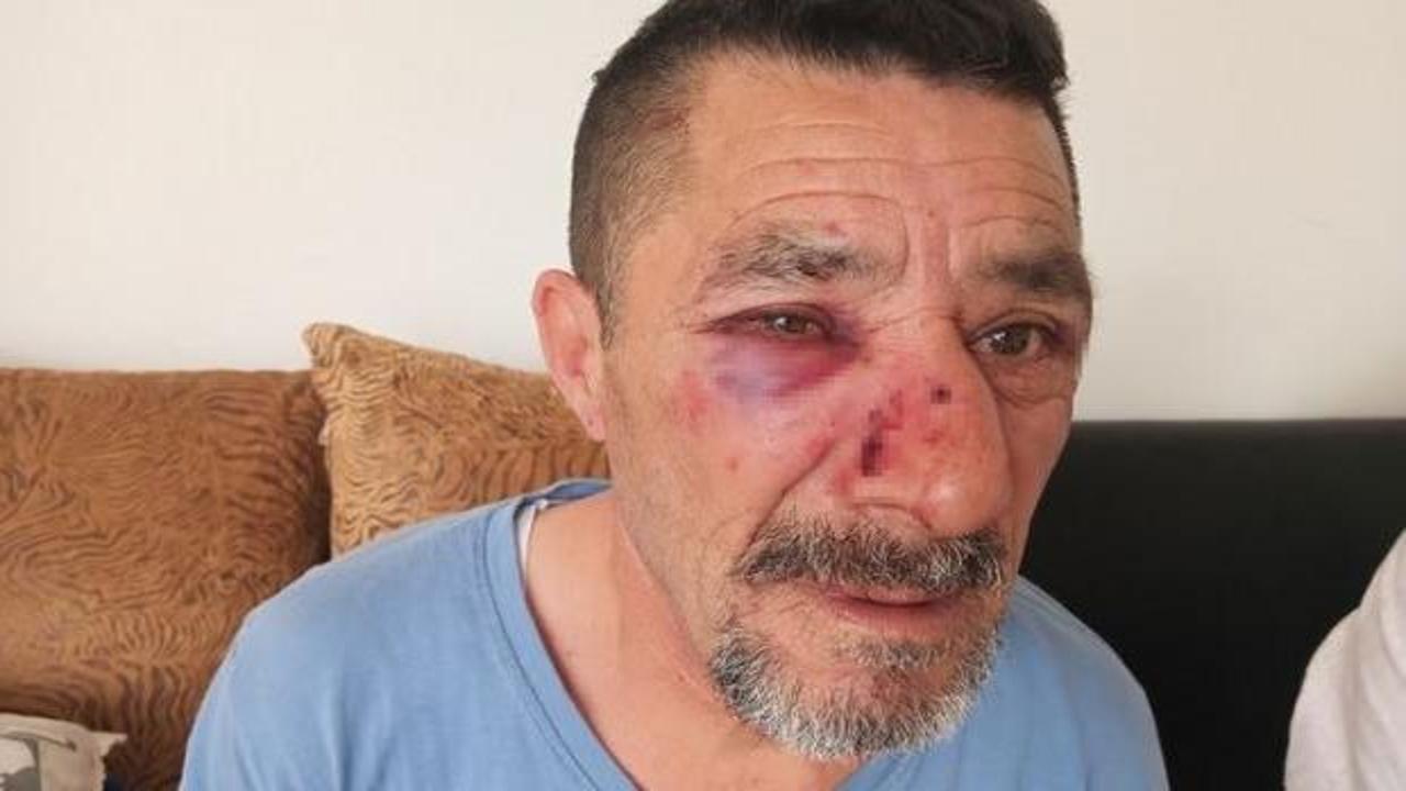Kiracılarını hastanelik eden ev sahibi tutuklandı!
