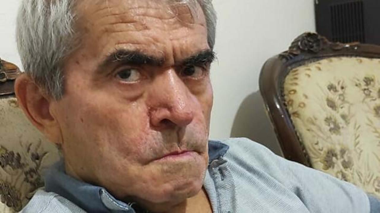 5 gündür kayıp olan Parkinson hastasının cansız bedeni bulundu
