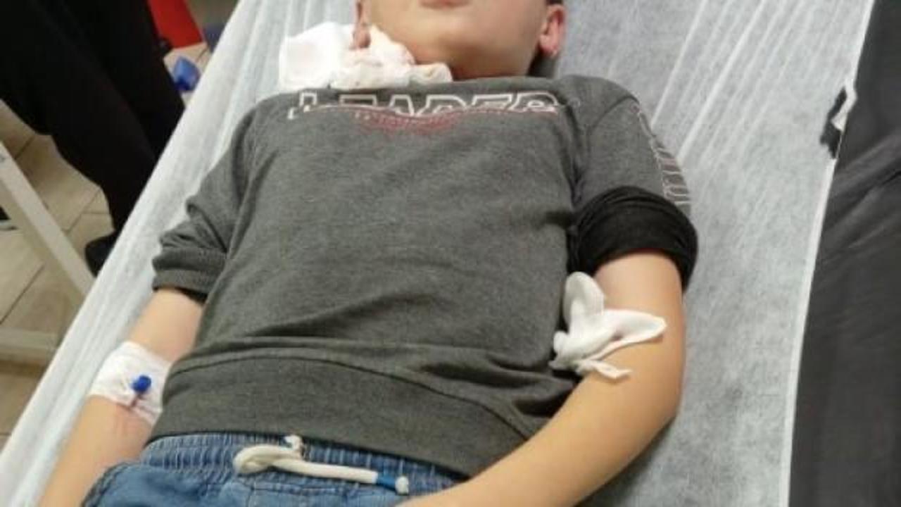 Akhisar'da başıboş köpek dehşeti: 10 yaşındaki çocuk yaralandı1