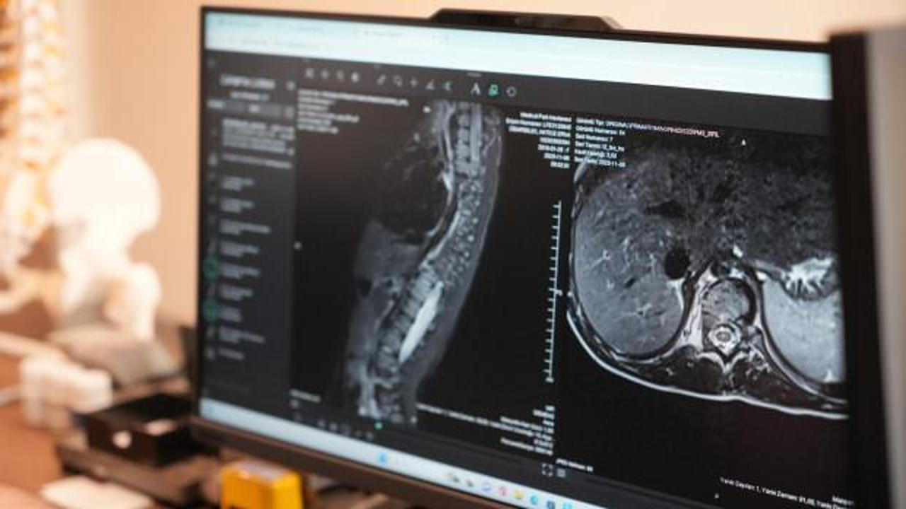 Anneler dikkat! Bu hastalığı ilk siz fark ediyorsunuz