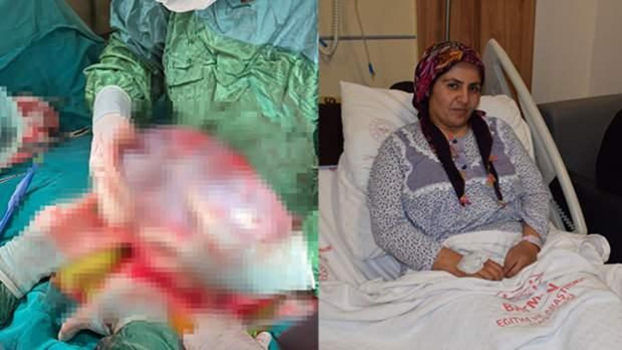 Engelli oğlu i&ccedil;in hastaneye gitmeyi erteledi! Dev kitleyle iki yıl yaşadı 