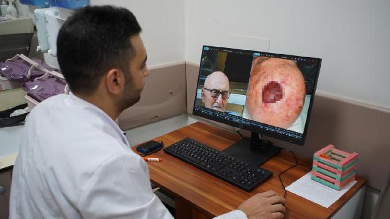 Literat&uuml;re ge&ccedil;en nadir vaka d&uuml;nyada 3'&uuml;nc&uuml; kez g&ouml;r&uuml;ld&uuml;