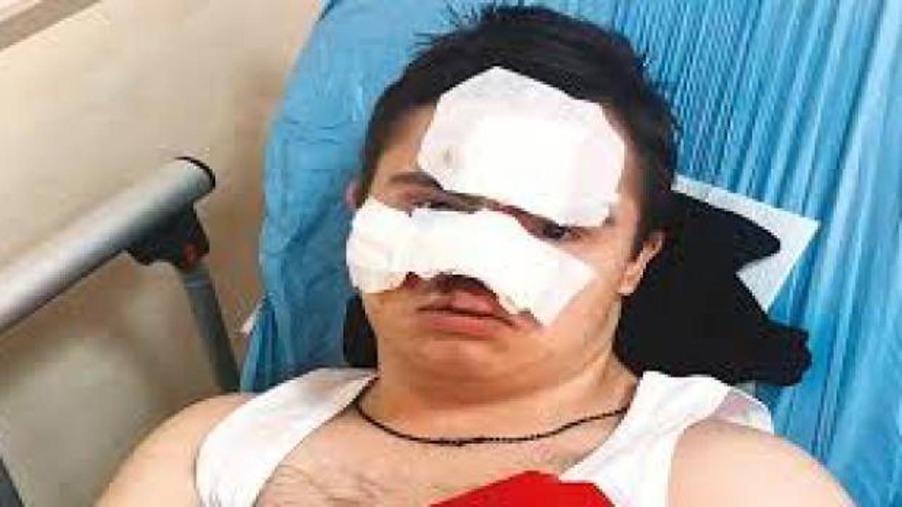 Down sendromlu &ccedil;ocuk okulda darbedildi iddiası! 