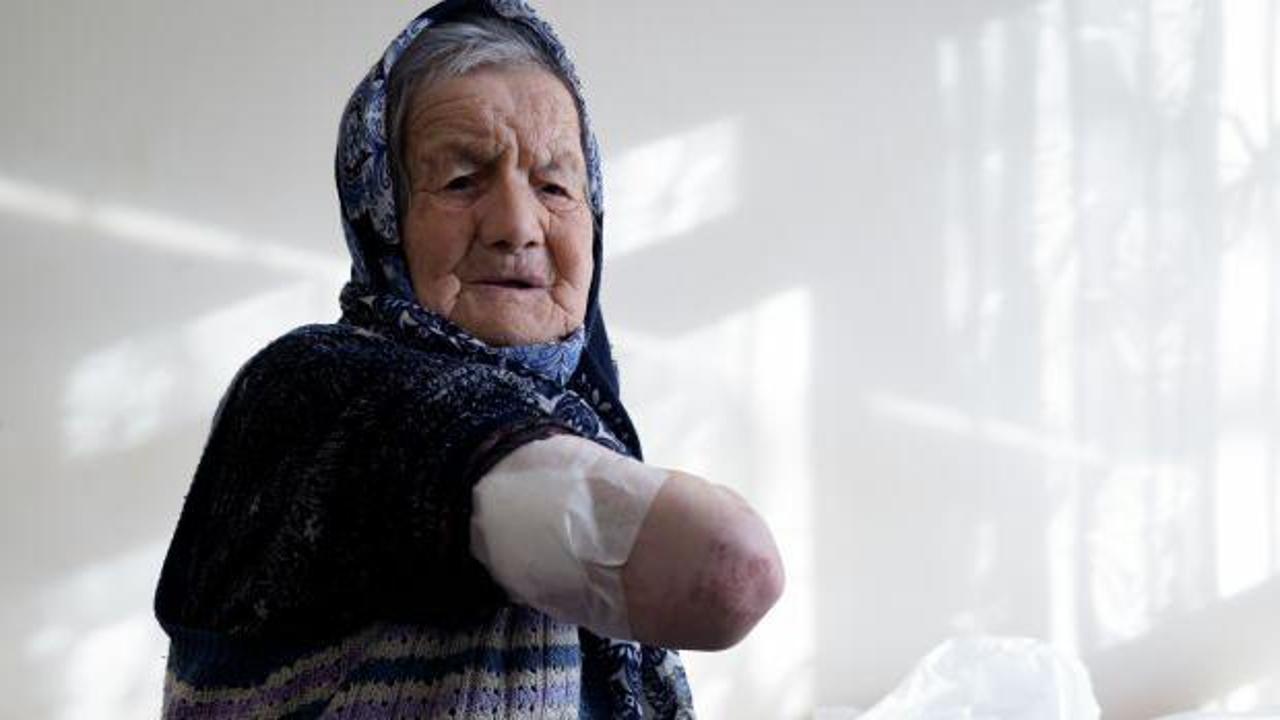 Ankara'da başıboş sokak k&ouml;peği yaşlı kadına saldırdı