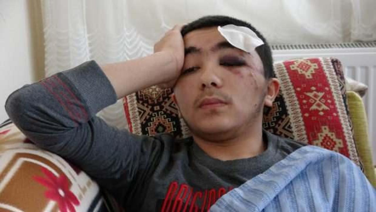 Isparta'da köpek dehşeti:16 yaşındaki Salih ölümden döndü! 