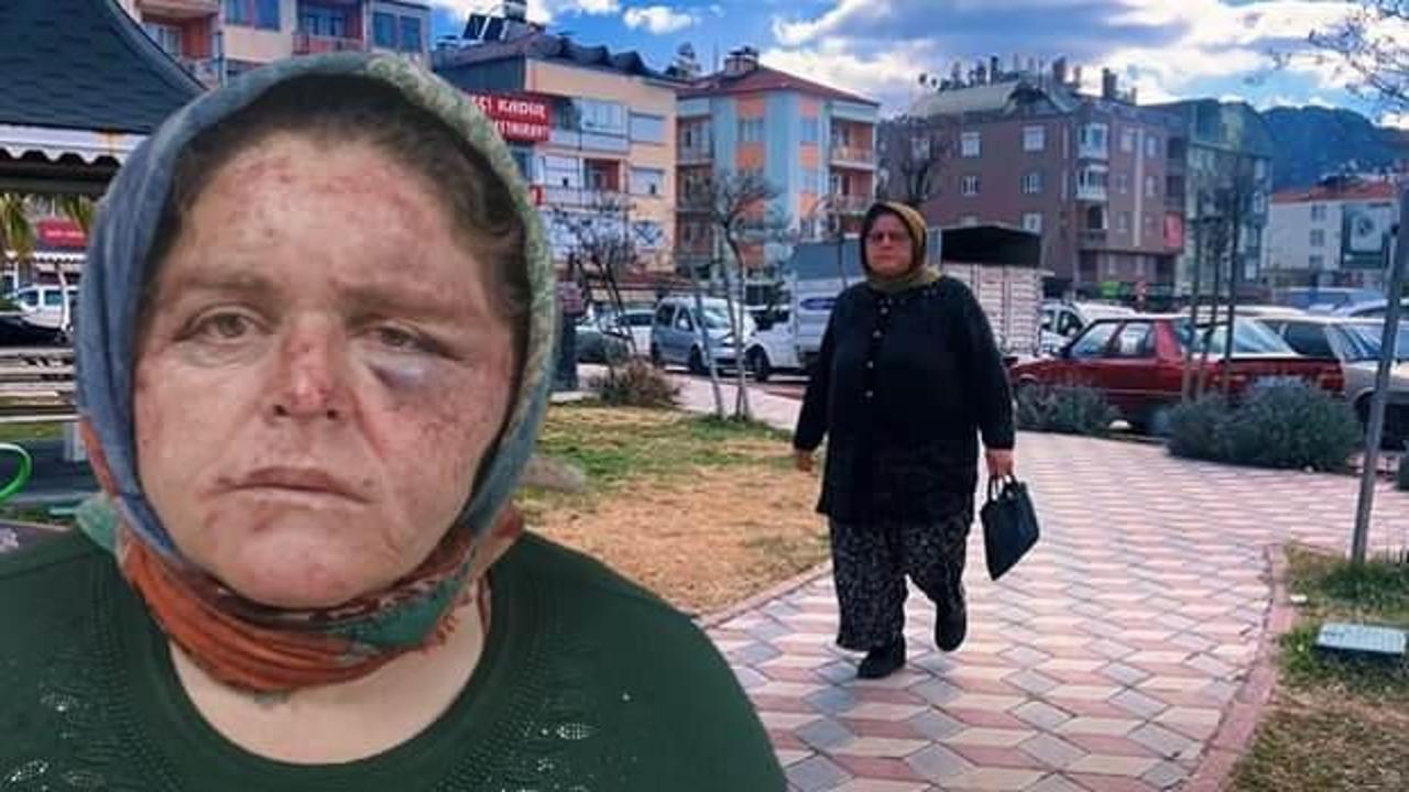 Oğlu dehşeti yaşattı: 'Tokat yemekten y&uuml;z&uuml;m tanınmaz hale geldi'