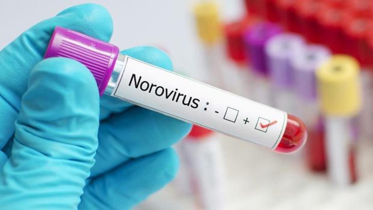 Uzmanından Norovirüs uyarısı! Bu belirtilerle karşılaşıyorsanız doktorun yolunu tutun