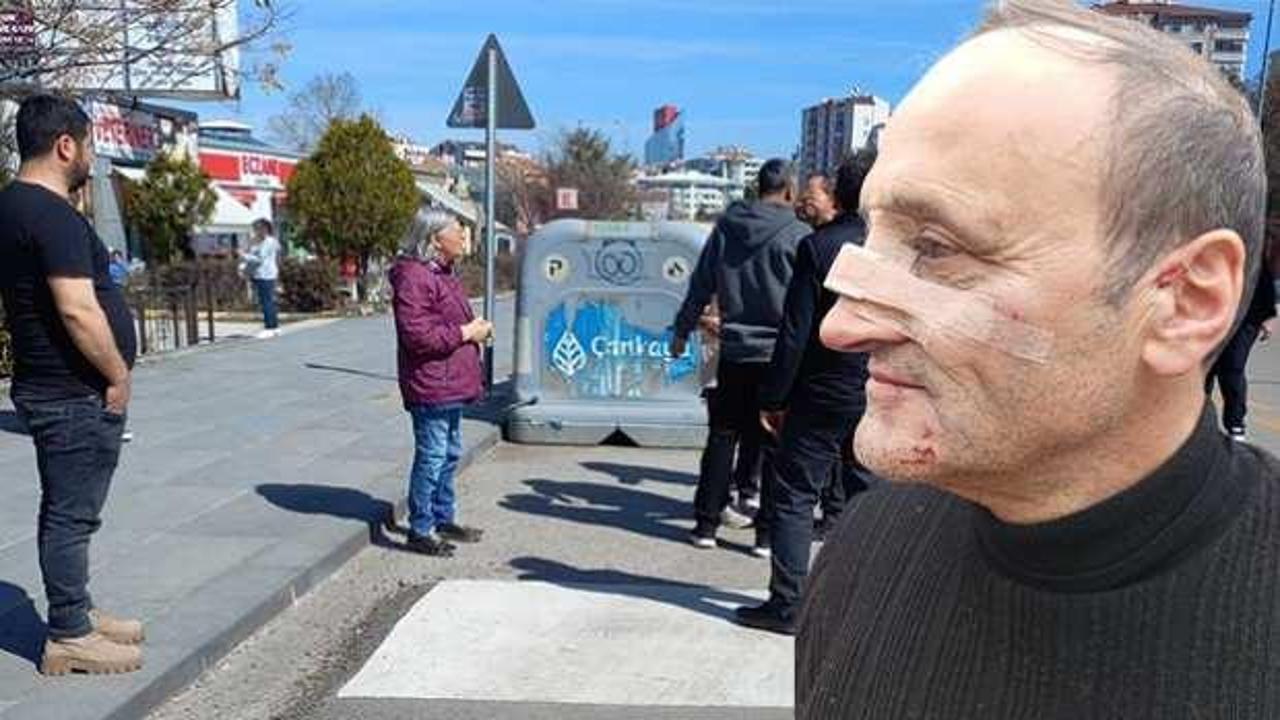 Ankara'da sokak k&ouml;peği tartışması: Eylemciler vatandaşın burnunu kırdı 