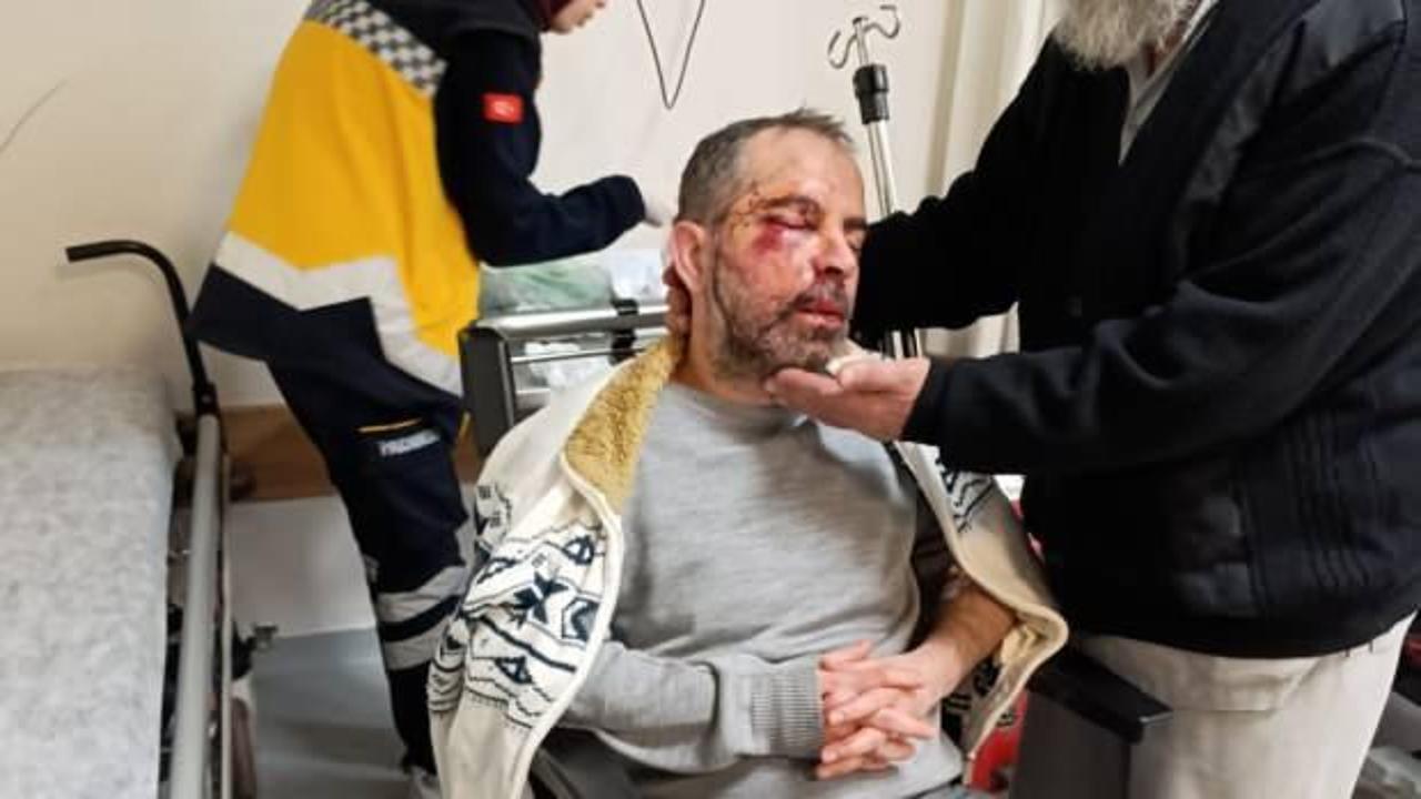 Konya’da köpek saldırısı! Ölümden döndü