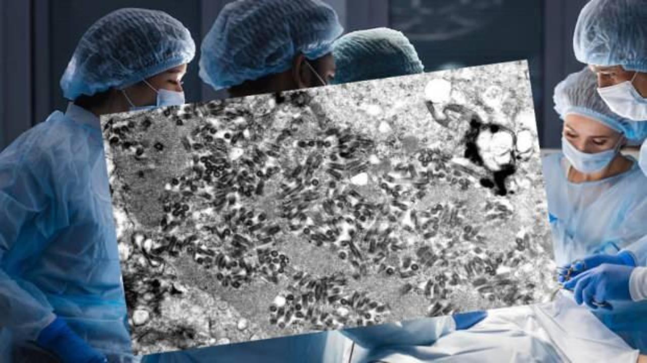 ABD'de bağışlanan organdan kuduz kapan adam öldü