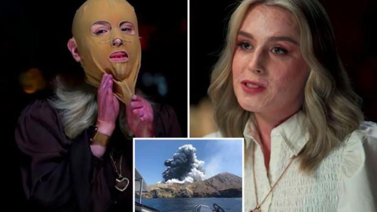 Tatil i&ccedil;in gittiği yerde hem v&uuml;cudu yandı, hem ailesini kaybetti