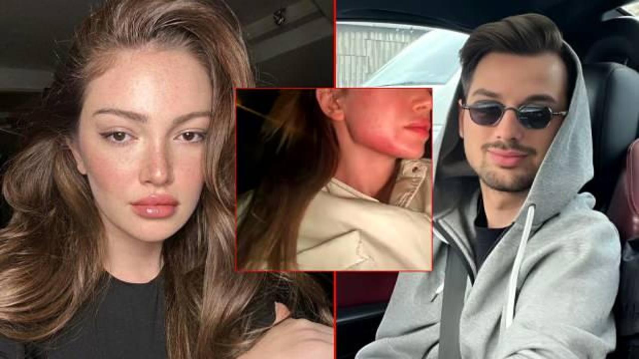 Danla Bilic'i darp eden eski sevgilisi Berk Çetin hakkında karar verildi