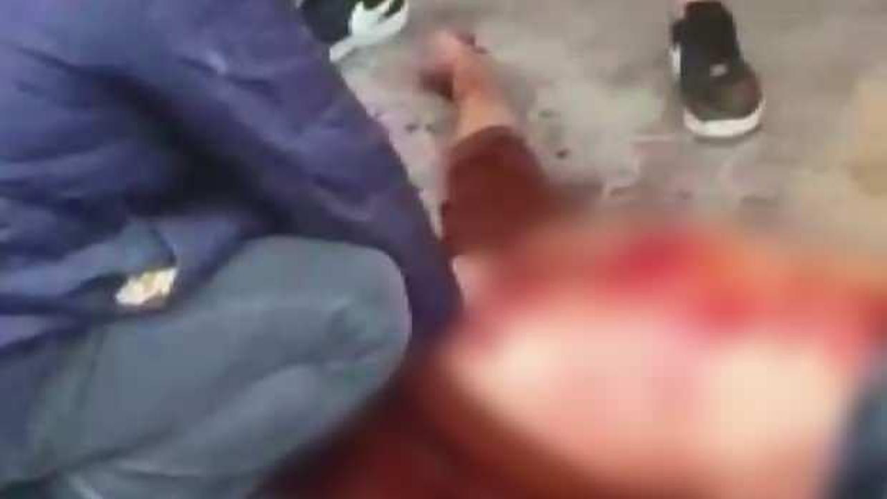 &Ccedil;ocukların kavgasına aileler karıştı: 1 &ouml;l&uuml;, 2 yaralı