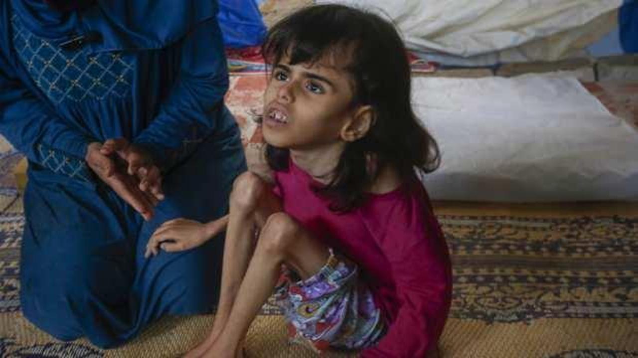 Gazze'de tam abluka! Uluslararası vicdan rafa kalktı!