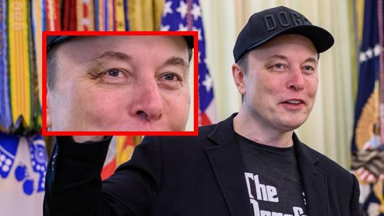 Sağ gözü neden mor? Elon Musk sebebini ...