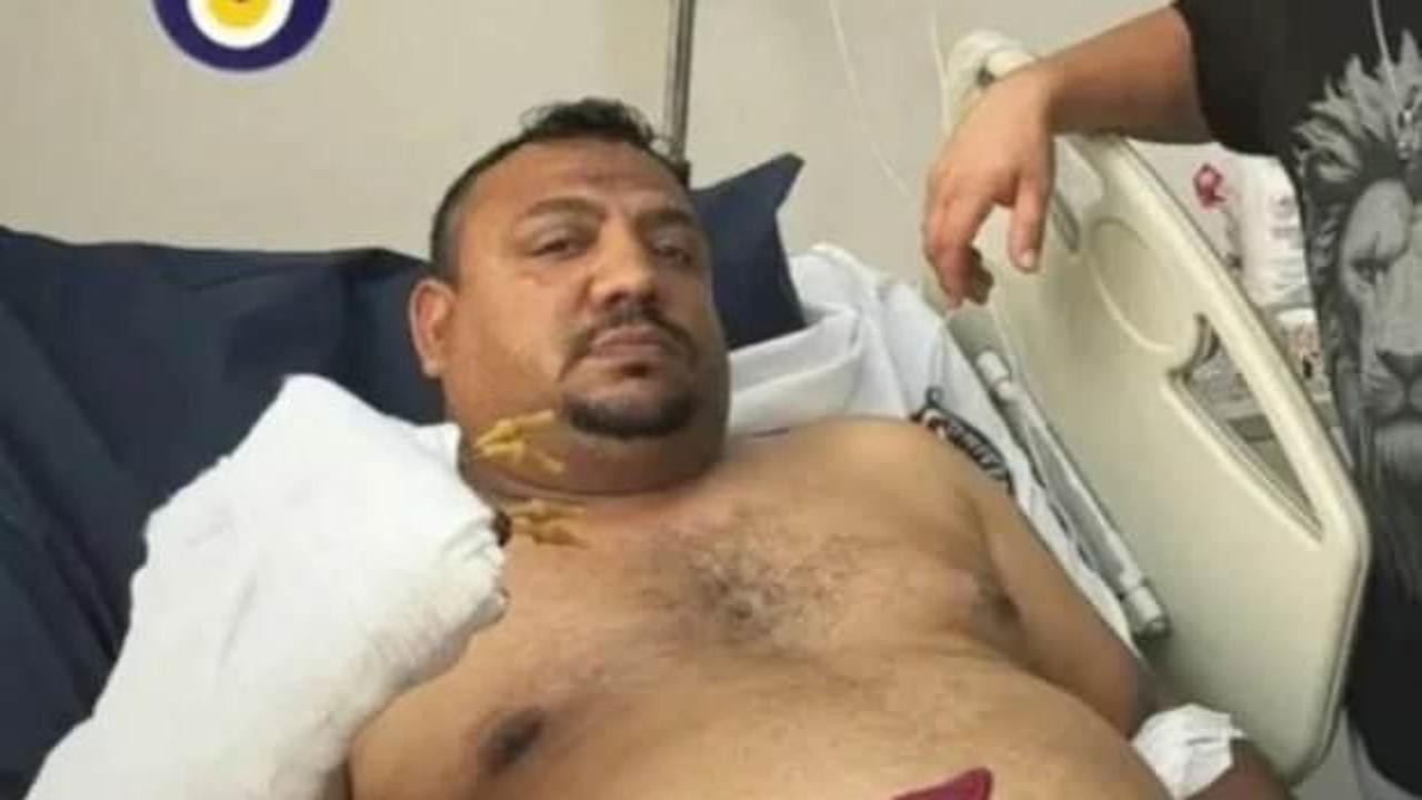 Osimhen&rsquo;le g&ouml;bek atan Kadir Ircı parmaklarını kaybetti