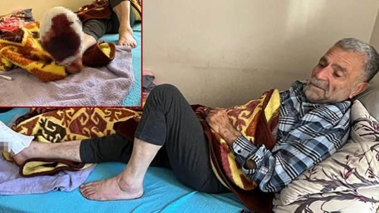 Ayağında oluşan açık yarası iyileşmeyen Muzaffer amca, ağlayarak yardım istedi 